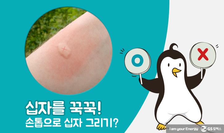 모기에 물렸을 때 올바른 대처법 | mosquito 05 1 1